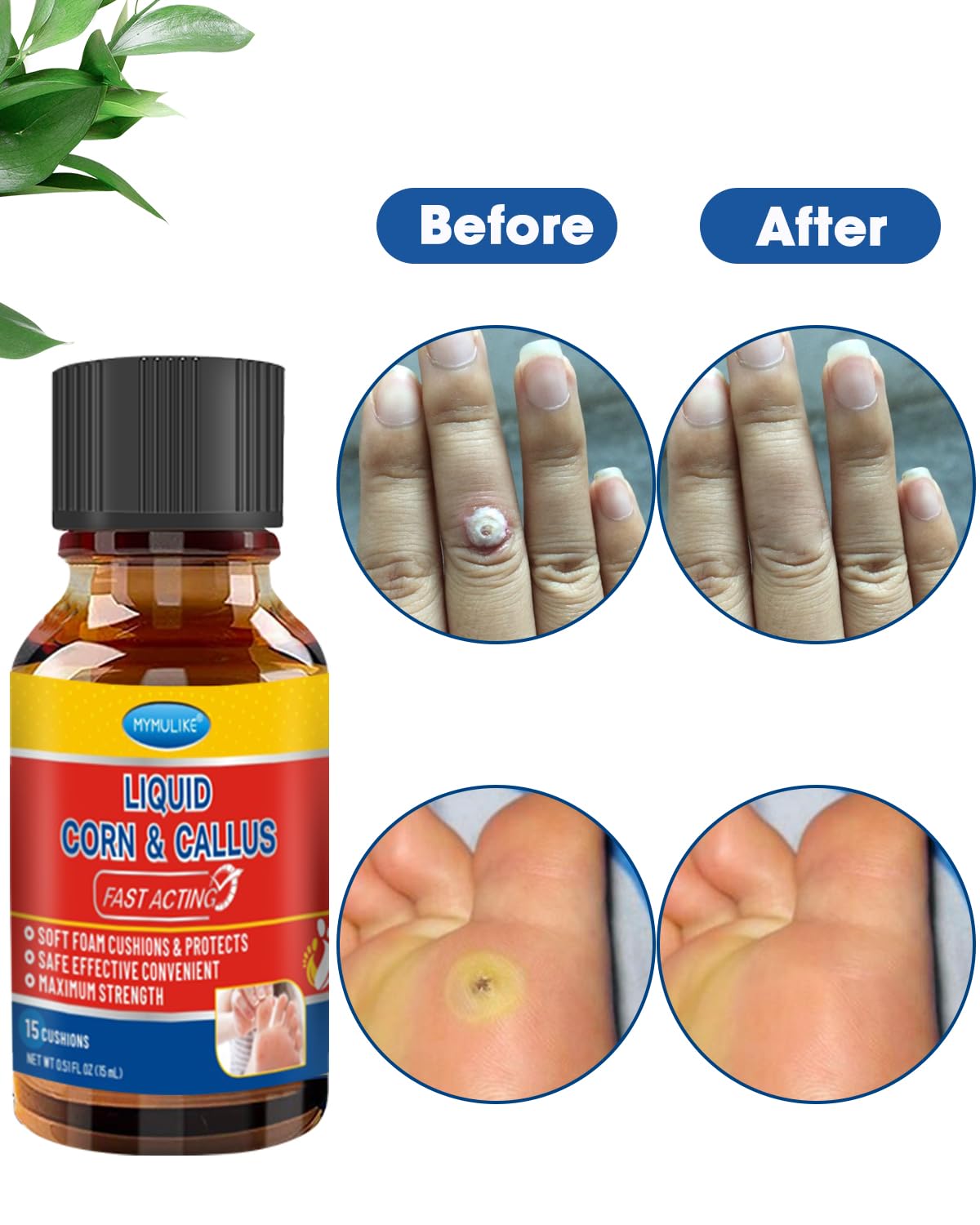 Liquid Corn Remover