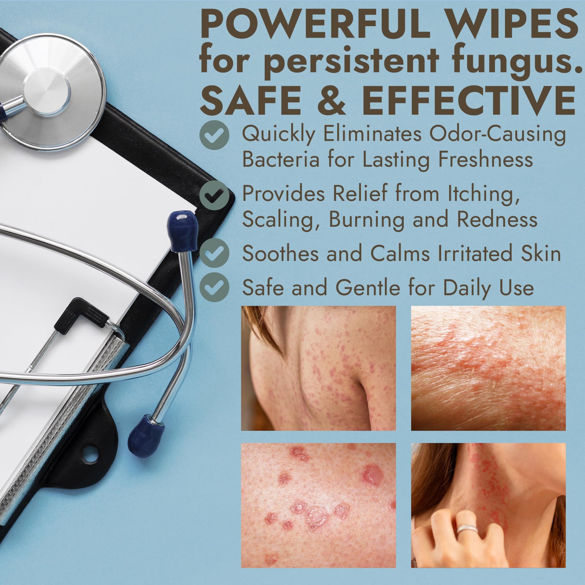 Antifungal Body Powder with Miconazole Nitrate 2% for Jock Itch & Ringworm (3 Ounce)
