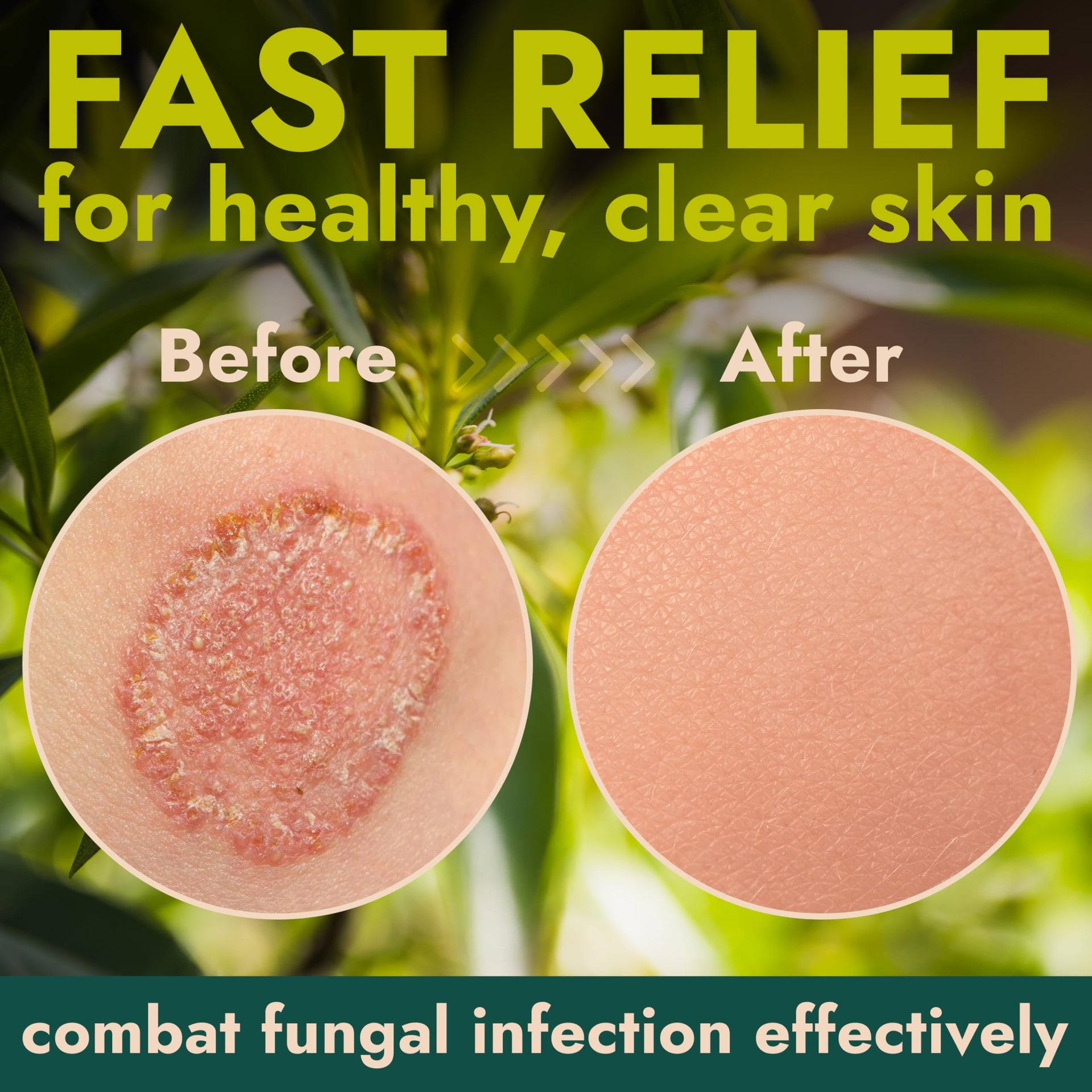 Antifungal Body Powder with Miconazole Nitrate 2% for Jock Itch & Ringworm (3 Ounce)