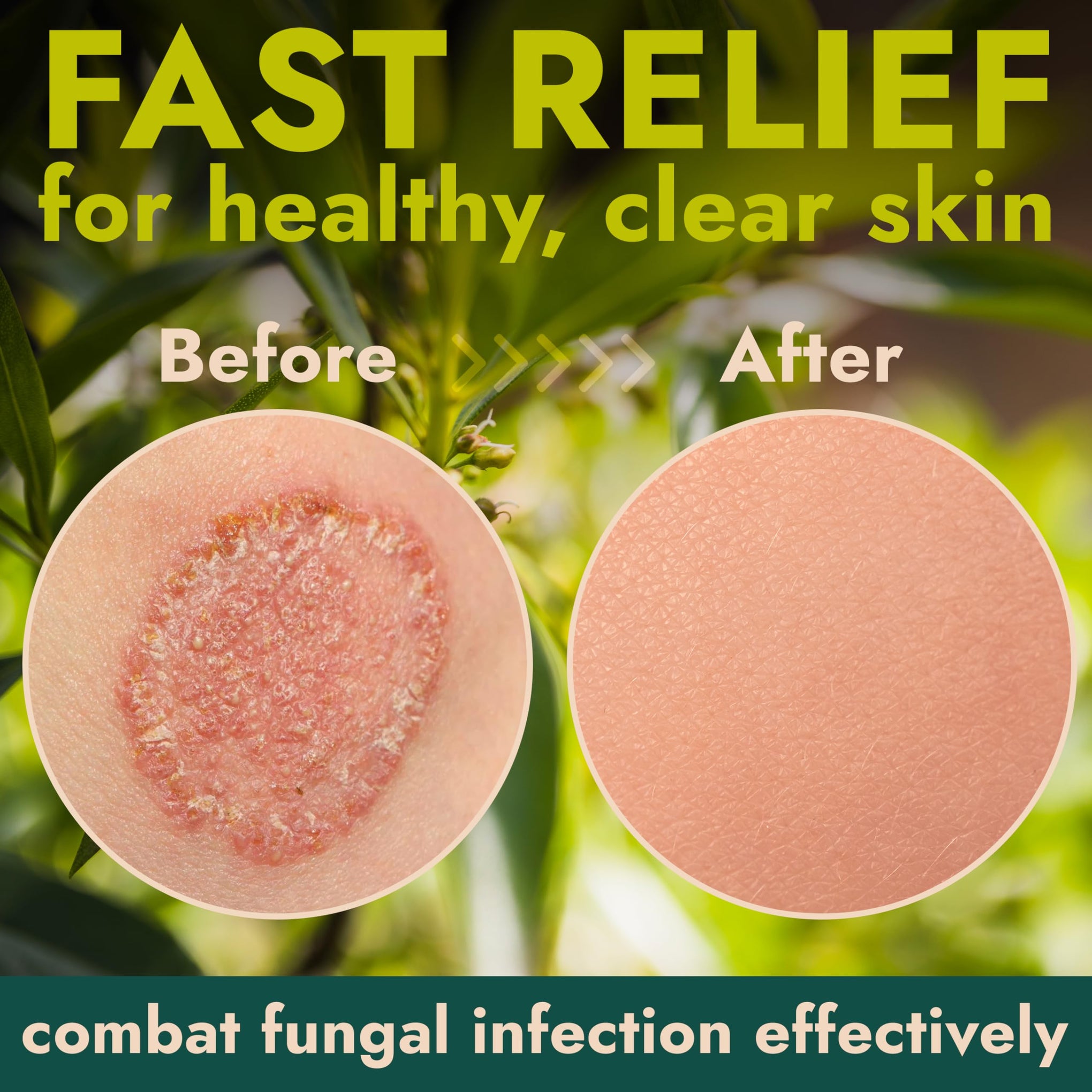 Antifungal Body Powder with Miconazole Nitrate 2% for Jock Itch & Ringworm (3 Ounce)